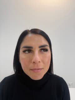 Dopo